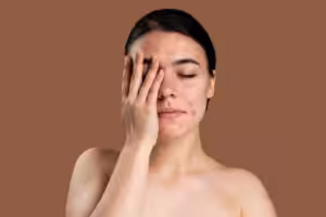 医美祛痘